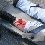 Verschiedenste Verletzungen finden die Übungsteilnehmer vor.