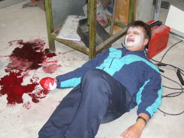 Amputationsverletzung in einer Werkstatt ©N. Sturm