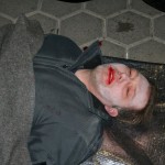 Eine Person mit einem Zungenbiss.