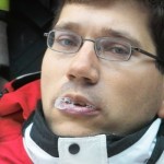 Eine dargestellte Verletzung